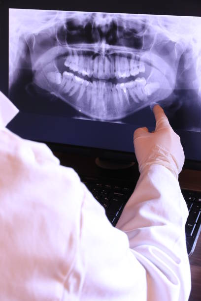 Best Emergency Dentist for Knocked-Out Tooth in South Yarmouth, MA