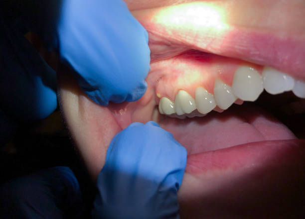 Best Orthodontic Emergency Dentist in South Yarmouth, MA
